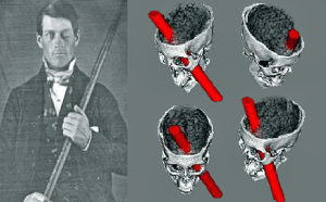 Phineas Gage